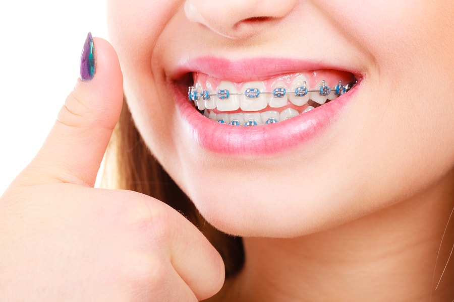 ORTHODONTIC TREATMENT